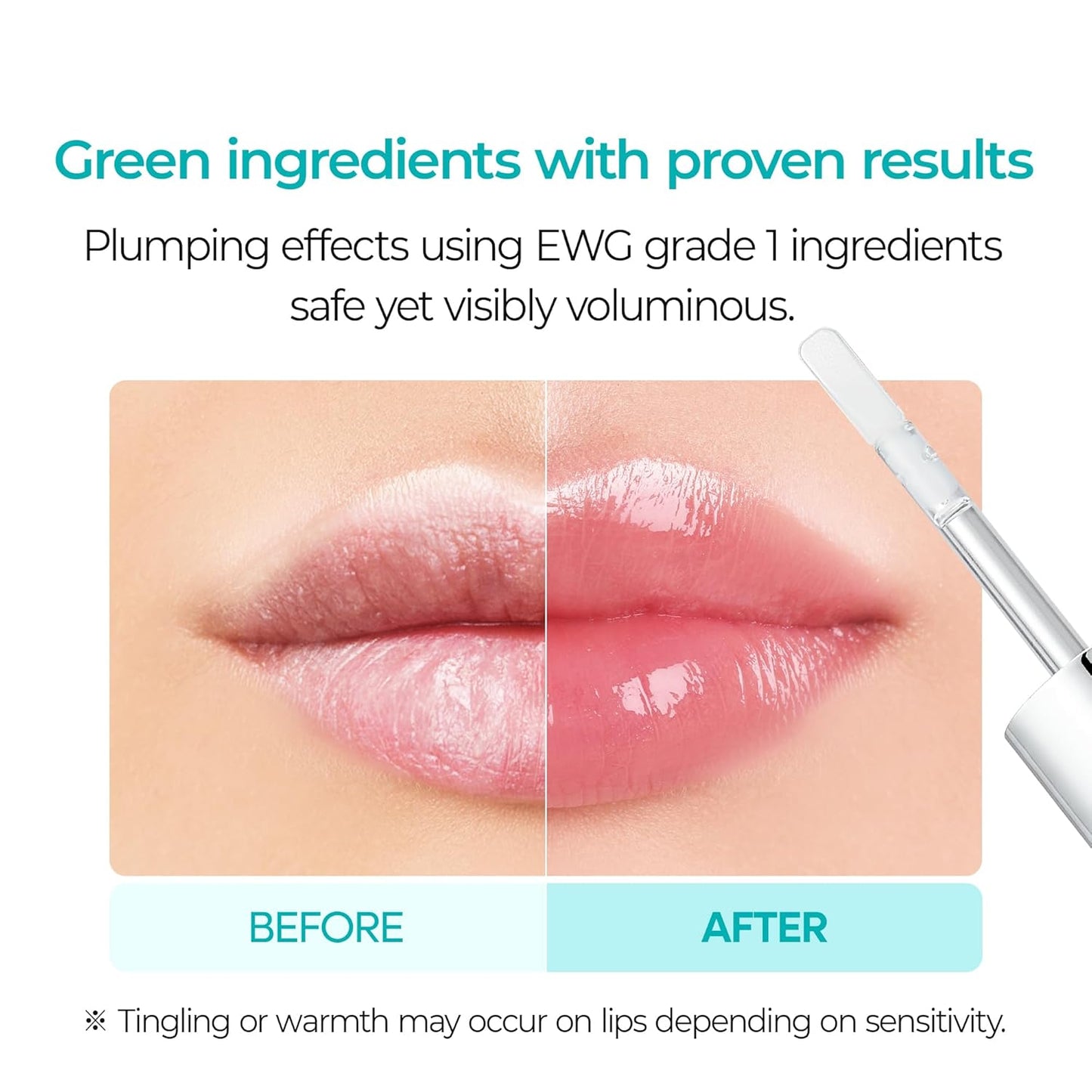 Veralift™  LipShot