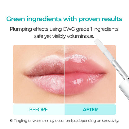 Veralift™  LipShot